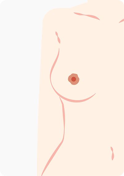 upic semi-permanent-areola