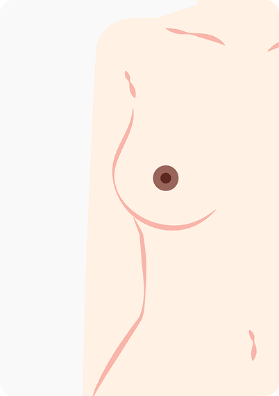 upic semi-permanent-areola