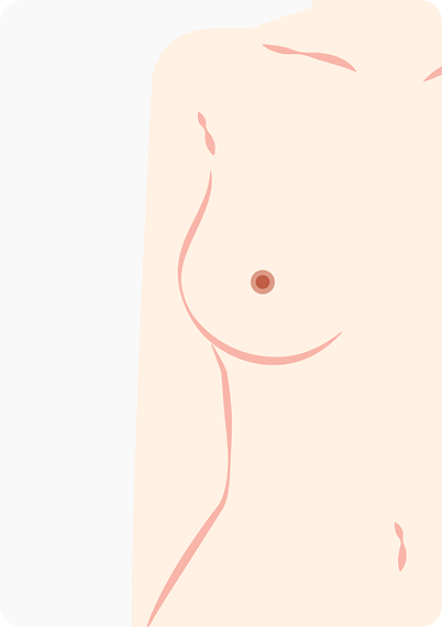 upic semi-permanent-areola