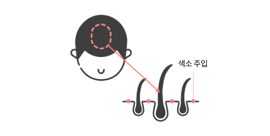 upic semi-permanent-scalp