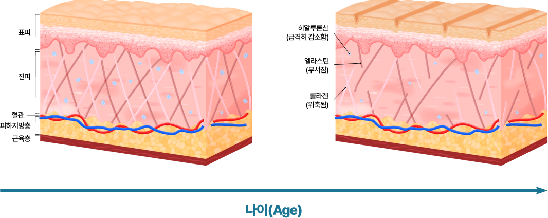 upic hydro-skinbomb